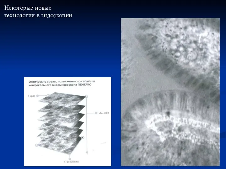 Некоторые новые технологии в эндоскопии