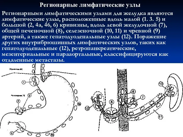 Регионарными лимфатическими узлами для желудка являются лимфатические узлы, расположенные вдоль малой