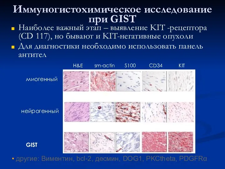 Иммуногистохимическое исследование при GIST Наиболее важный этап – выявление KIT -рецептора