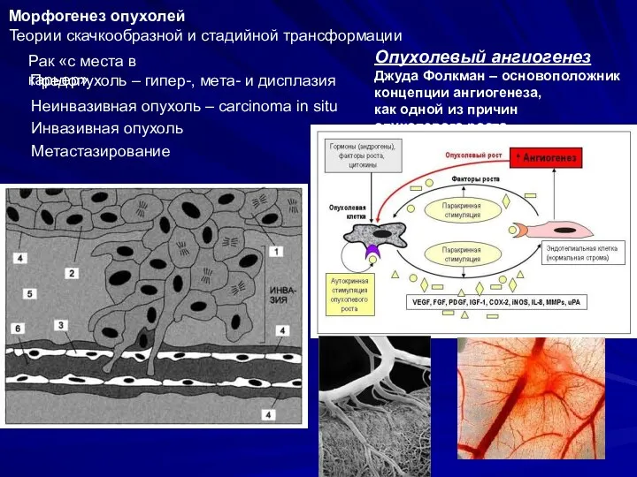 Морфогенез опухолей Теории скачкообразной и стадийной трансформации Рак «с места в