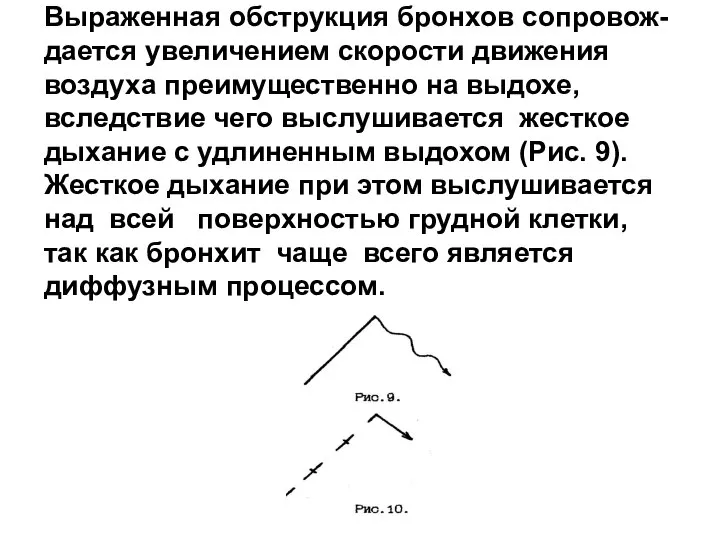 Выраженная обструкция бронхов сопровож-дается увеличением скорости движения воздуха преимущественно на выдохе,