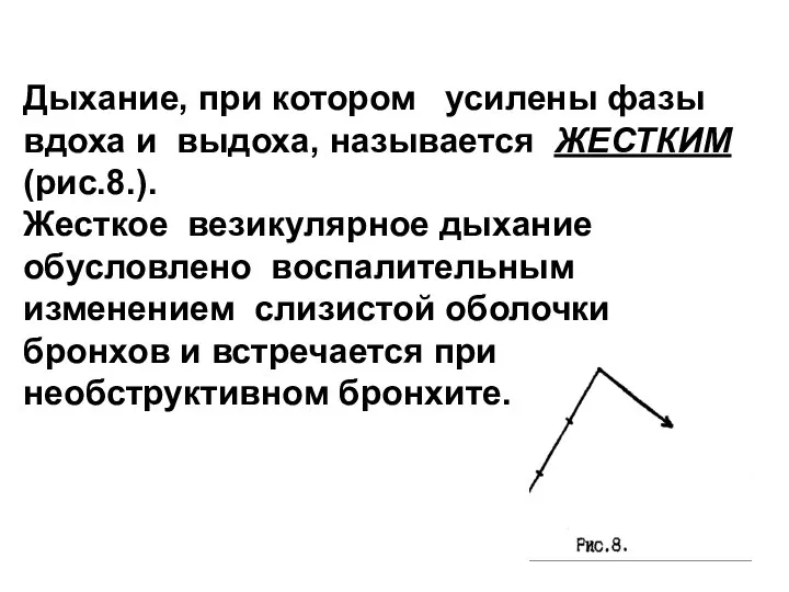 Дыхание, при котором усилены фазы вдоха и выдоха, называется ЖЕСТКИМ (рис.8.).