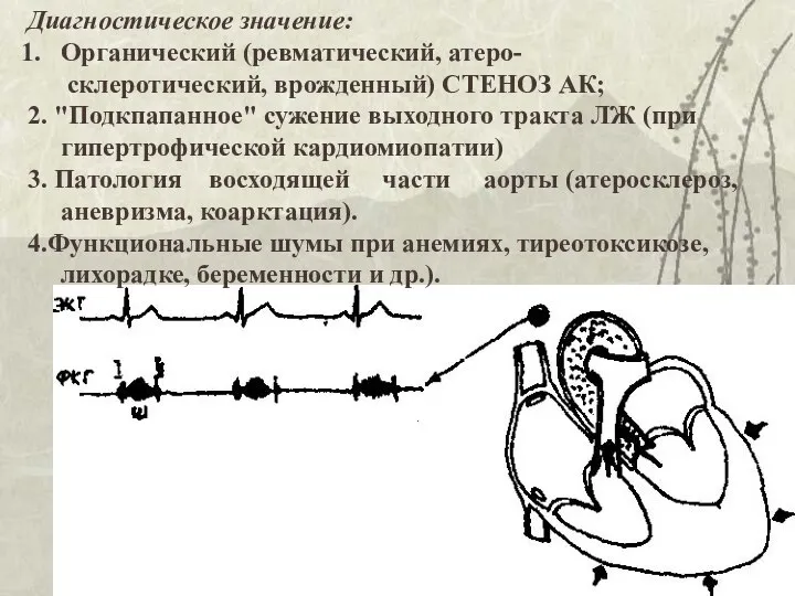 Диагностическое значение: Органический (ревматический, атеро- склеротический, врожденный) СТЕНОЗ АК; 2. "Подкпапанное"