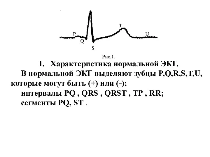 Характеристика нормальной ЭКГ. В нормальной ЭКГ выделяют зубцы P,Q,R,S,T,U, которые могут