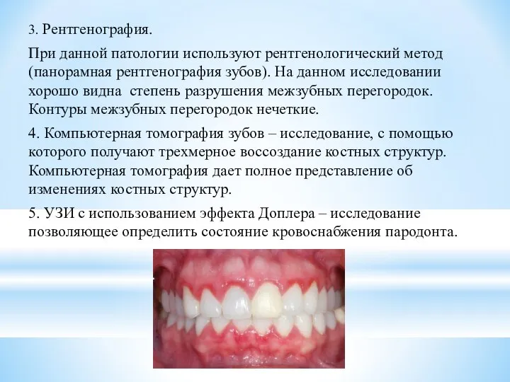 3. Рентгенография. При данной патологии используют рентгенологический метод (панорамная рентгенография зубов).