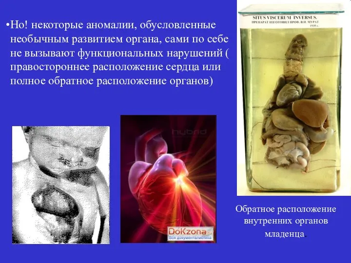 Но! некоторые аномалии, обусловленные необычным развитием органа, сами по себе не