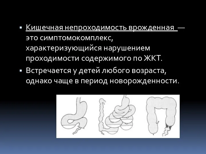 Кишечная непроходимость врожденная — это симптомокомплекс, характеризующийся нарушением проходимости содержимого по