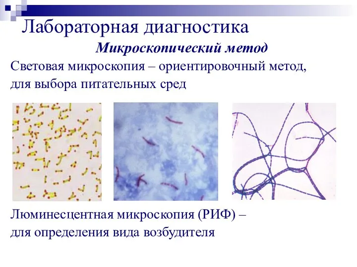 Лабораторная диагностика Микроскопический метод Световая микроскопия – ориентировочный метод, для выбора