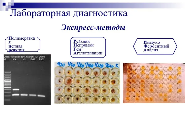 Лабораторная диагностика Экспресс-методы Полимеразная цепная реакция Реакция Непрямой Гем Агглютинации Иммуно Ферментный Анализ