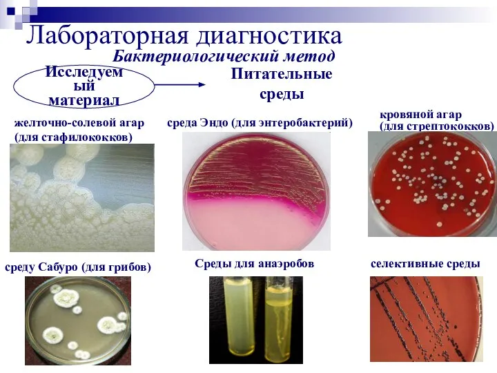 Лабораторная диагностика Бактериологический метод Исследуемый материал Питательные среды желточно-солевой агар (для