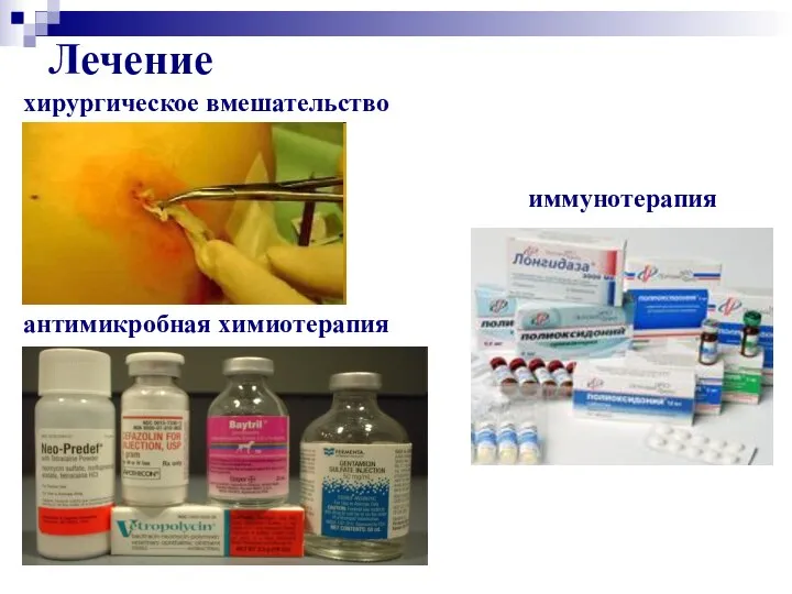 Лечение хирургическое вмешательство антимикробная химиотерапия иммунотерапия