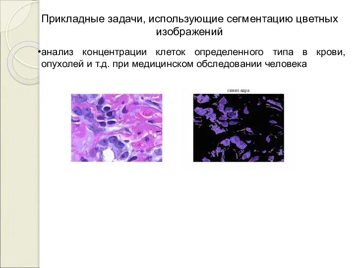 Прикладные задачи, использующие сегментацию цветных изображений анализ концентрации клеток определенного типа