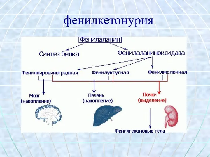 фенилкетонурия