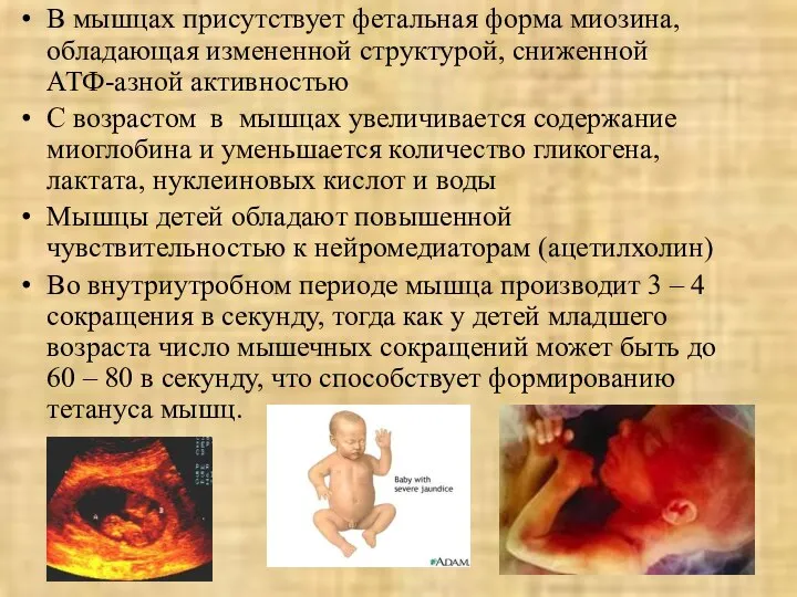 В мышцах присутствует фетальная форма миозина, обладающая измененной структурой, сниженной АТФ-азной