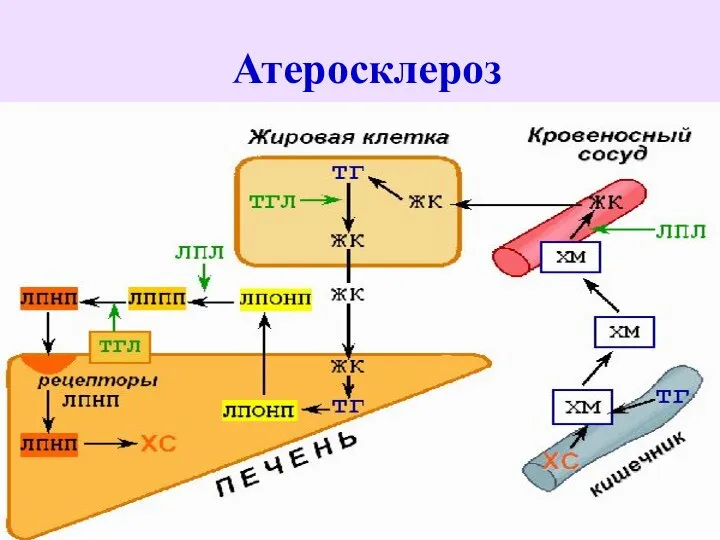 Атеросклероз