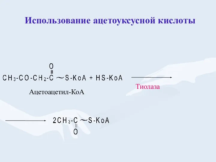 Использование ацетоуксусной кислоты Тиолаза Ацетоацетил-КоА