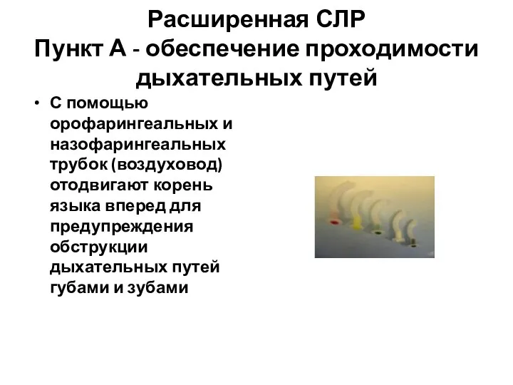 Расширенная СЛР Пункт А - обеспечение проходимости дыхательных путей С помощью