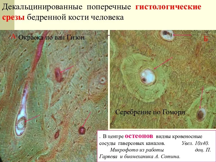 Декальцинированные поперечные гистологические срезы бедренной кости человека . В центре остеонов