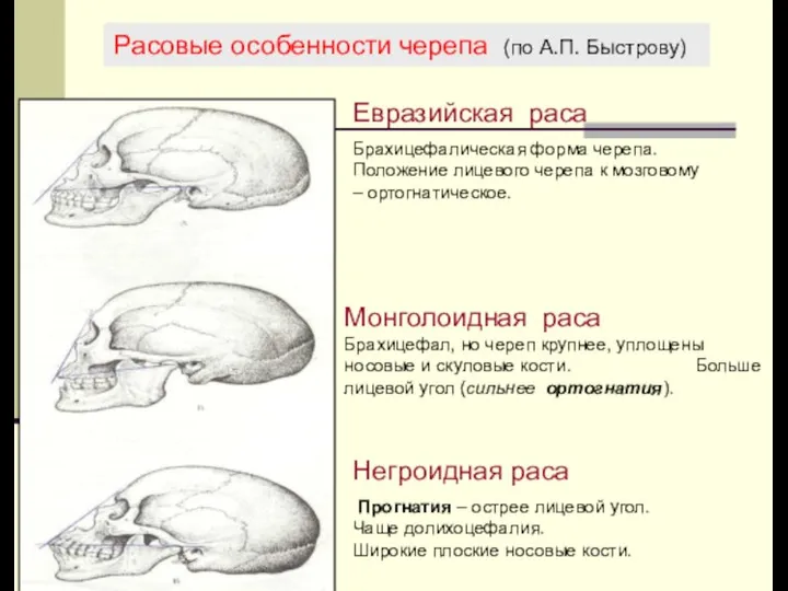 Расовые особенности черепа (по А.П. Быстрову) Евразийская раса Брахицефалическая форма черепа.