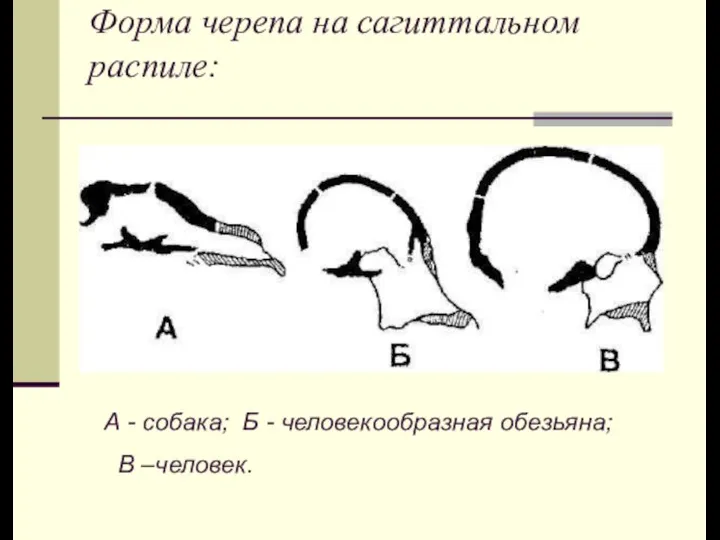 Форма черепа на сагиттальном распиле: А - собака; Б - человекообразная обезьяна; В –человек.