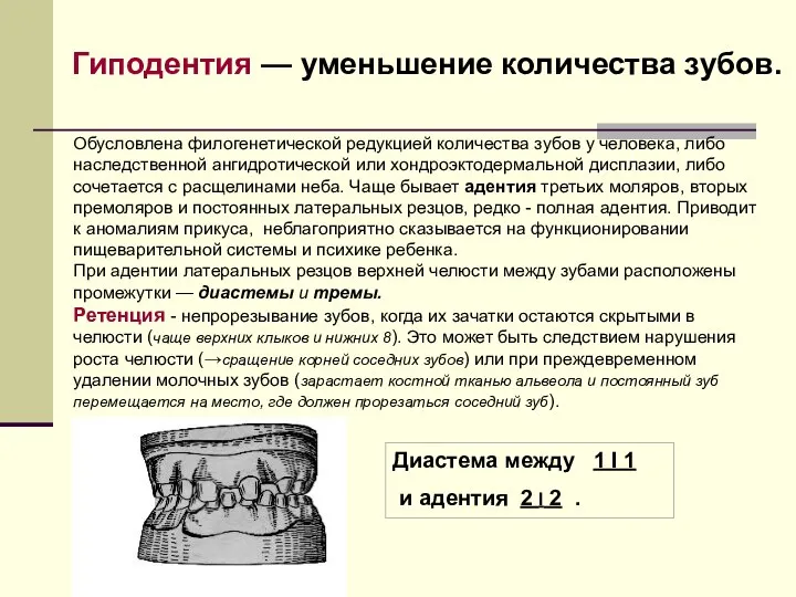 Обусловлена филогенетической редукцией количества зубов у человека, либо наследственной ангидротической или