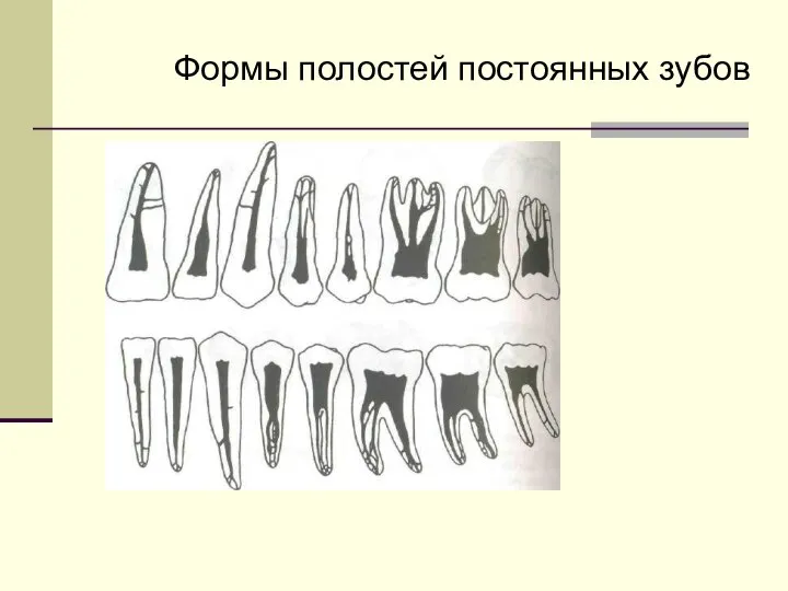 Формы полостей постоянных зубов