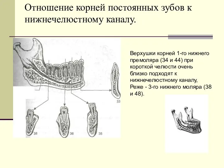 Отношение корней постоянных зубов к нижнечелюстному каналу. Верхушки корней 1-го нижнего