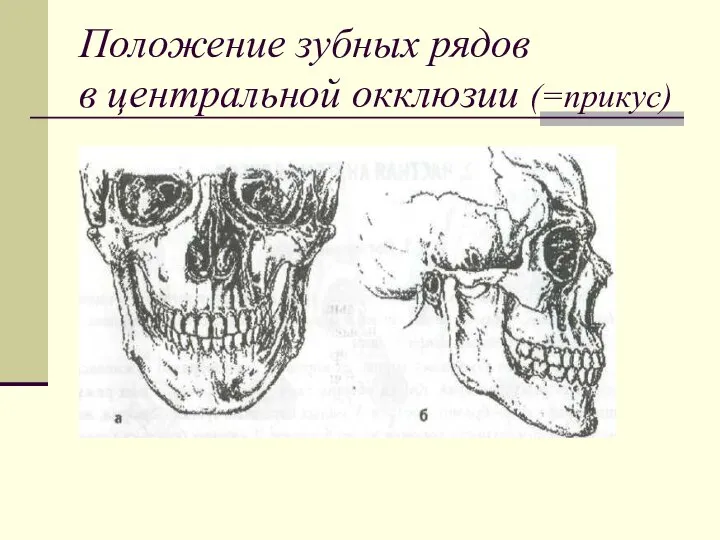 Положение зубных рядов в центральной окклюзии (=прикус)