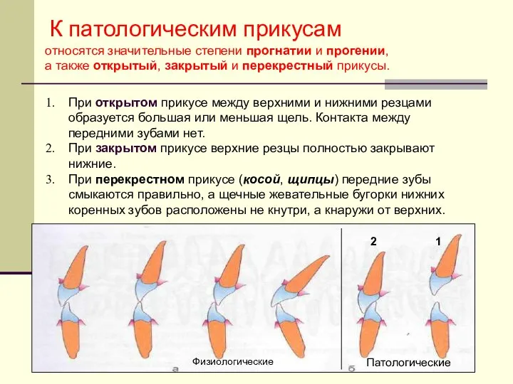 При открытом прикусе между верхними и нижними резцами образуется большая или