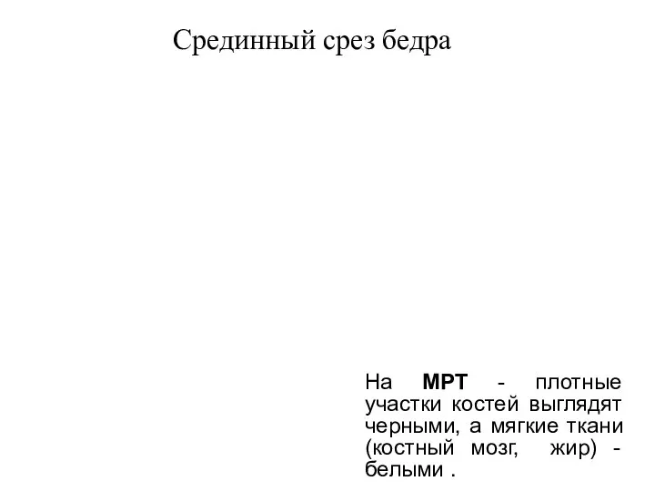 На МРТ - плотные участки костей выглядят черными, а мягкие ткани