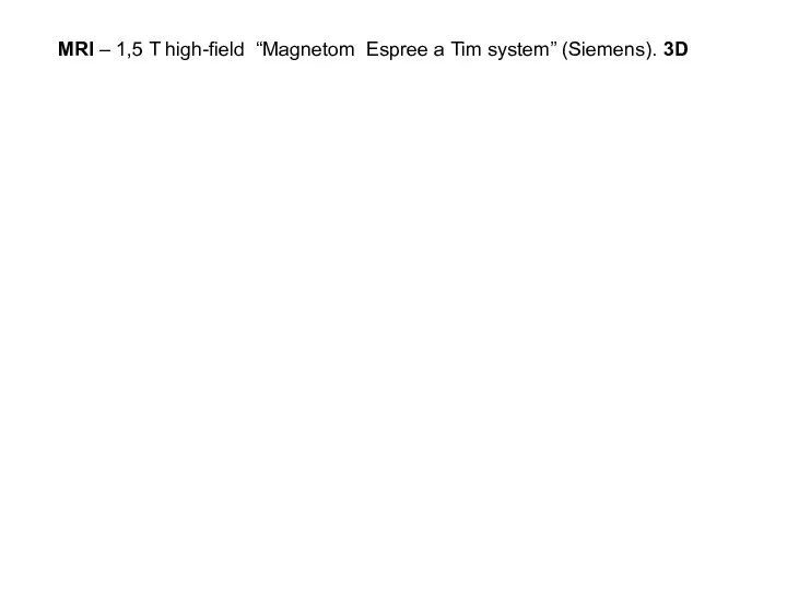 MRI – 1,5 T high-field “Magnetom Espree a Tim system” (Siemens). 3D