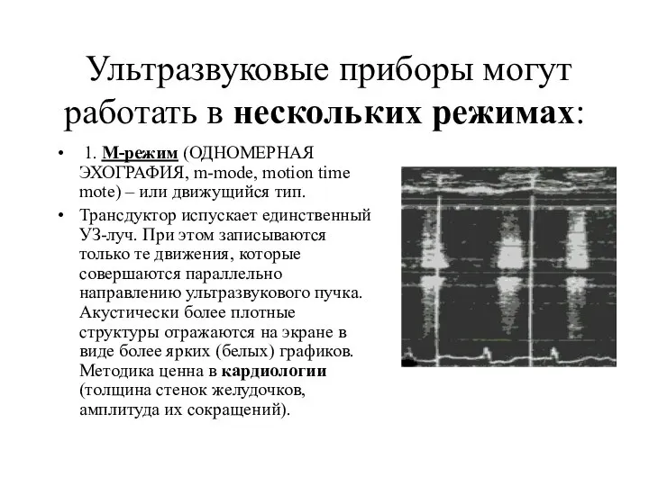 Ультразвуковые приборы могут работать в нескольких режимах: 1. М-режим (ОДНОМЕРНАЯ ЭХОГРАФИЯ,