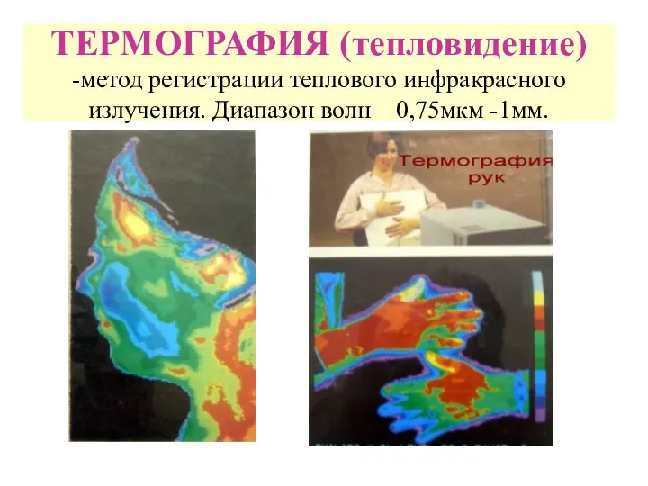 ТЕРМОГРАФИЯ (тепловидение) -метод регистрации теплового инфракрасного излучения. Диапазон волн – 0,75мкм -1мм.