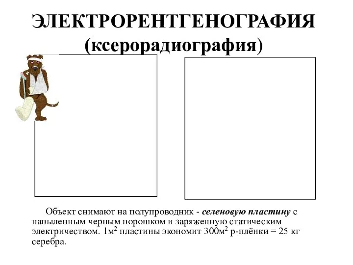 ЭЛЕКТРОРЕНТГЕНОГРАФИЯ (ксерорадиография) Объект снимают на полупроводник - селеновую пластину с напыленным