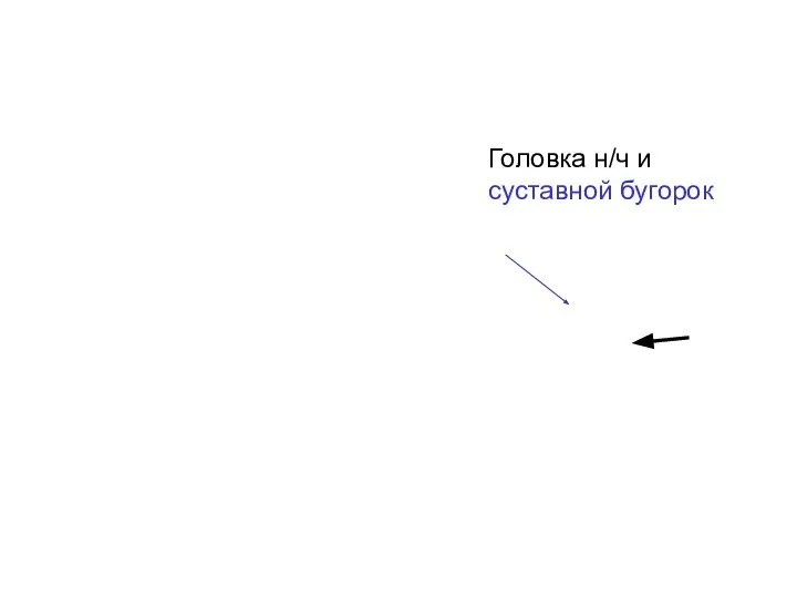 Головка н/ч и суставной бугорок