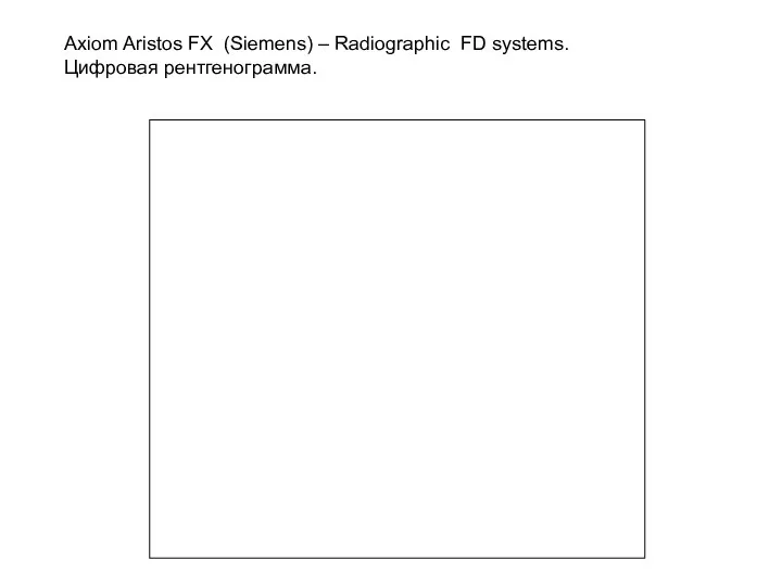 Axiom Aristos FX (Siemens) – Radiographic FD systems. Цифровая рентгенограмма.