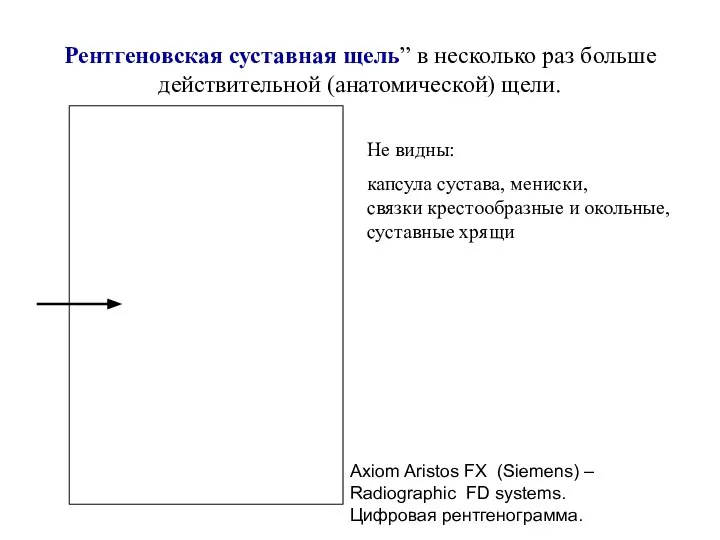 Рентгеновская суставная щель” в несколько раз больше действительной (анатомической) щели. Axiom