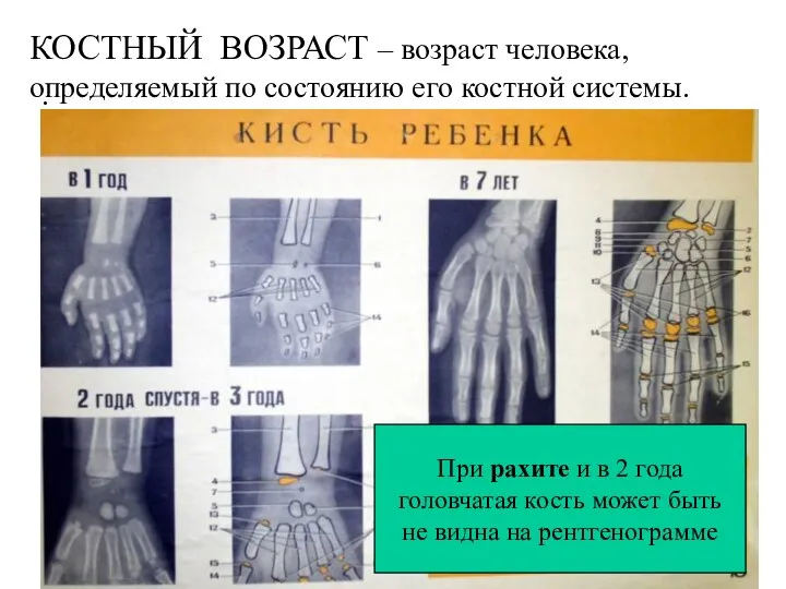 . КОСТНЫЙ ВОЗРАСТ – возраст человека, определяемый по состоянию его костной