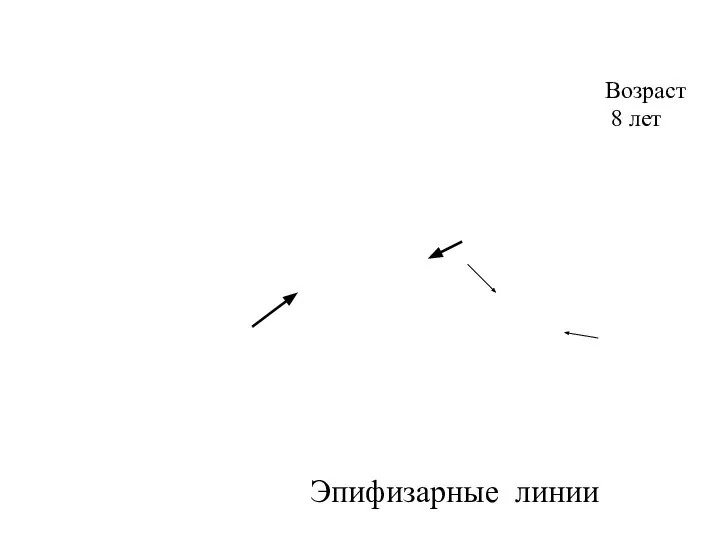 Возраст 8 лет Эпифизарные линии