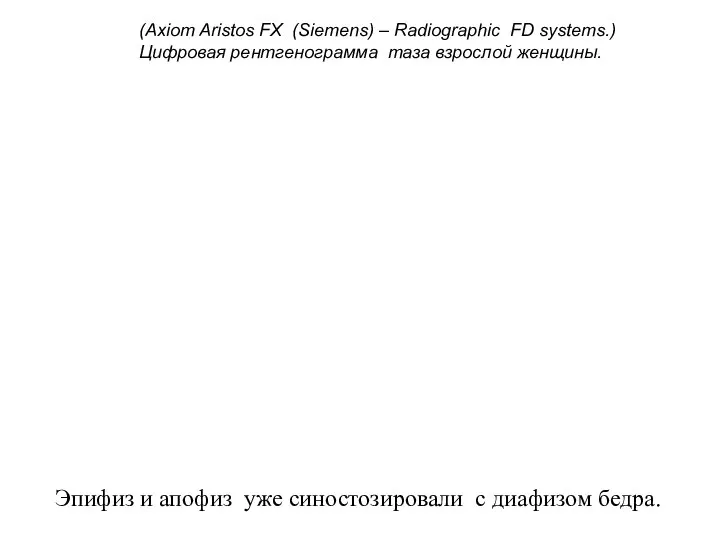 (Axiom Aristos FX (Siemens) – Radiographic FD systems.) Цифровая рентгенограмма таза