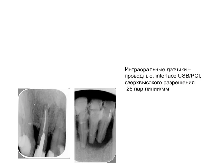 Интраоральные датчики – проводные, interface USB/PCI, сверхвысокого разрешения -26 пар линий/мм