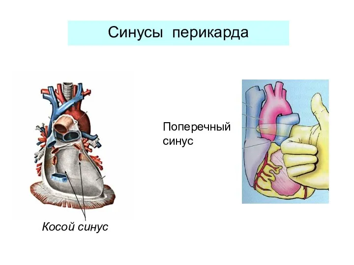 Синусы перикарда Косой синус Поперечный синус