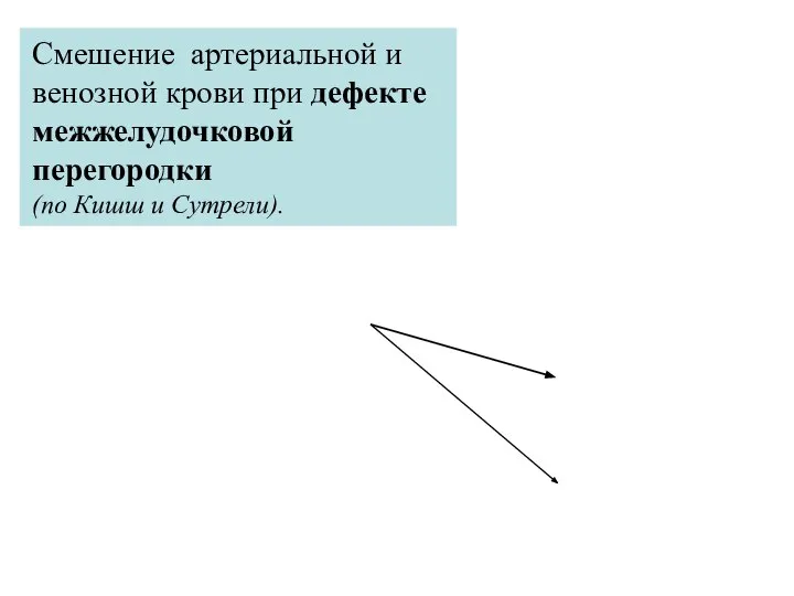 Cмешение артериальной и венозной крови при дефекте межжелудочковой перегородки (по Кишш и Сутрели).