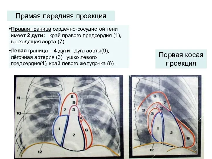 Прямая передняя проекция Первая косая проекция Правая граница сердечно-сосудистой тени имеет