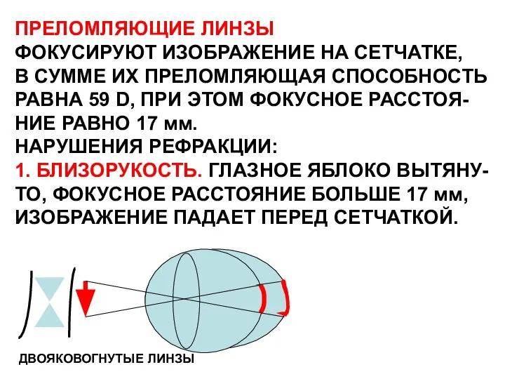 ПРЕЛОМЛЯЮЩИЕ ЛИНЗЫ ФОКУСИРУЮТ ИЗОБРАЖЕНИЕ НА СЕТЧАТКЕ, В СУММЕ ИХ ПРЕЛОМЛЯЮЩАЯ СПОСОБНОСТЬ