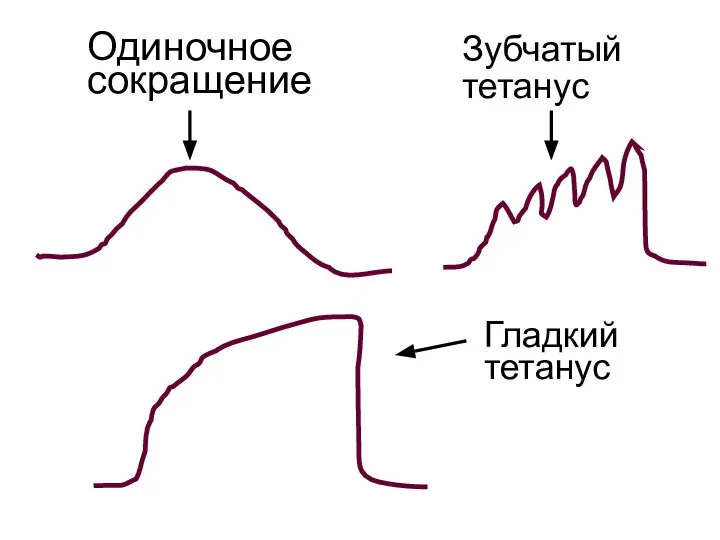 Одиночное сокращение Зубчатый тетанус Гладкий тетанус