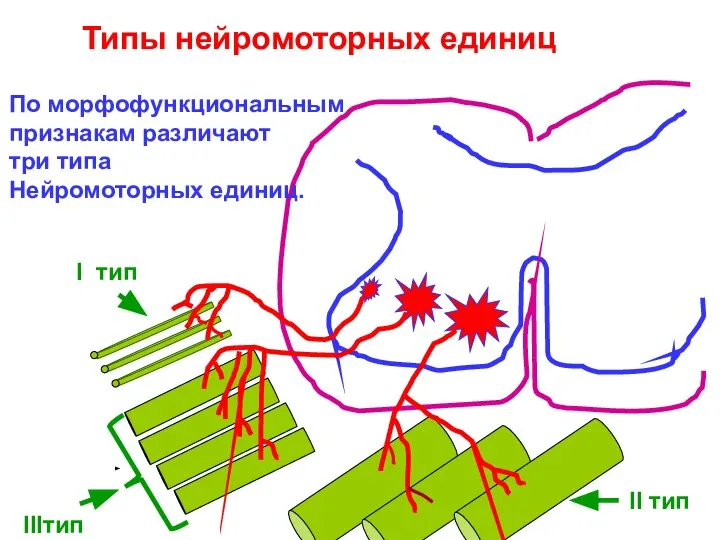 Типы нейромоторных единиц I тип IIIтип II тип По морфофункциональным признакам различают три типа Нейромоторных единиц.