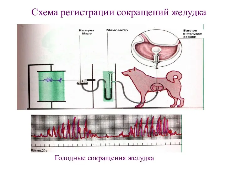 Схема регистрации сокращений желудка Голодные сокращения желудка