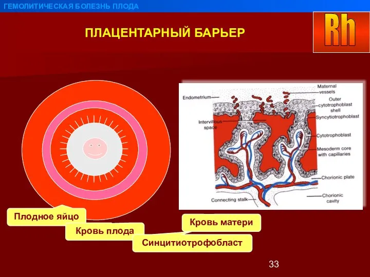 ПЛАЦЕНТАРНЫЙ БАРЬЕР ГЕМОЛИТИЧЕСКАЯ БОЛЕЗНЬ ПЛОДА Плодное яйцо Кровь плода Синцитиотрофобласт Кровь матери