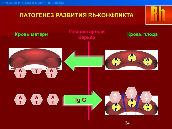 ПАТОГЕНЕЗ РАЗВИТИЯ Rh-КОНФЛИКТА ГЕМОЛИТИЧЕСКАЯ БОЛЕЗНЬ ПЛОДА Плацентарный барьер Кровь плода Кровь